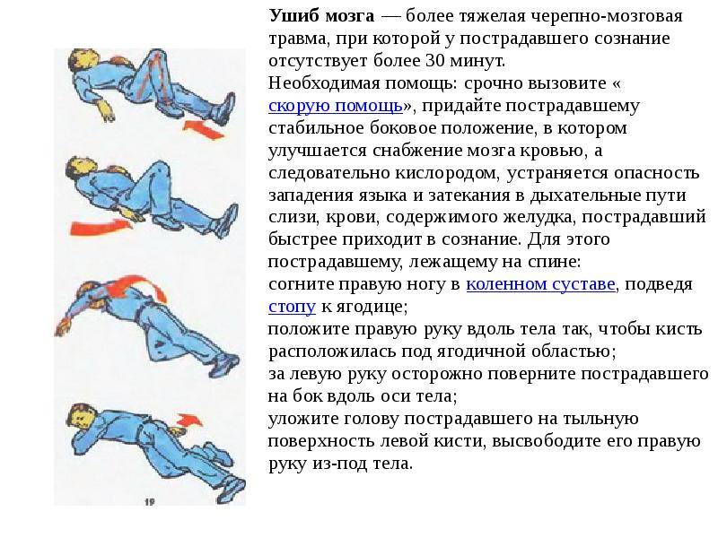 Черепно-мозговая травма у взрослых и детей. что нужно знать