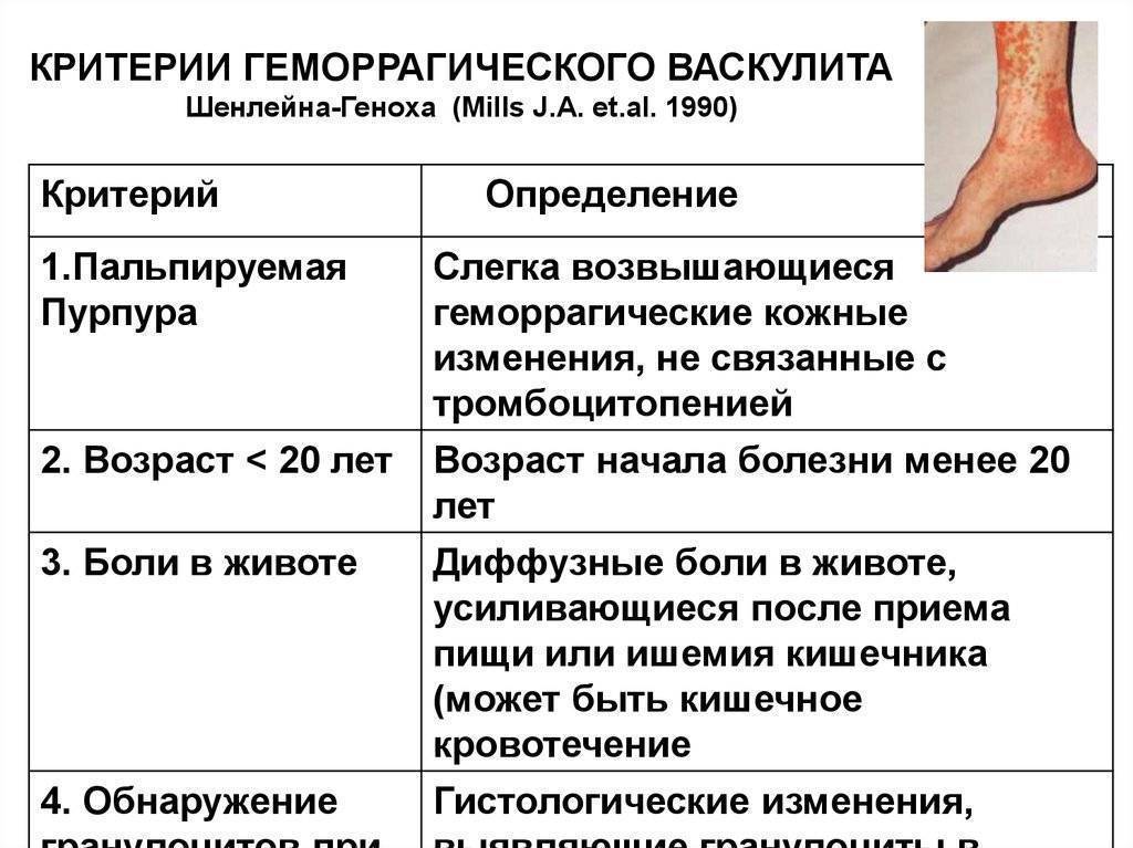 Гемморагический васкулит