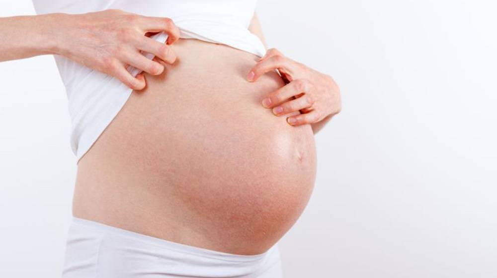 Почему чешется живот при беременности и что с этим делать