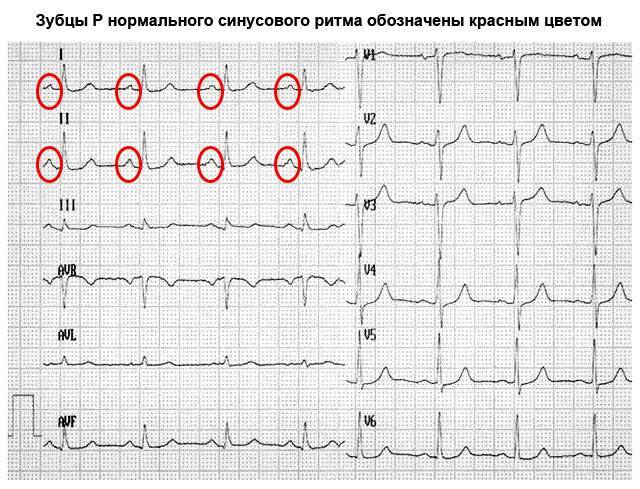 Расшифровка узи сердца: показатели нормы эхокардиографии