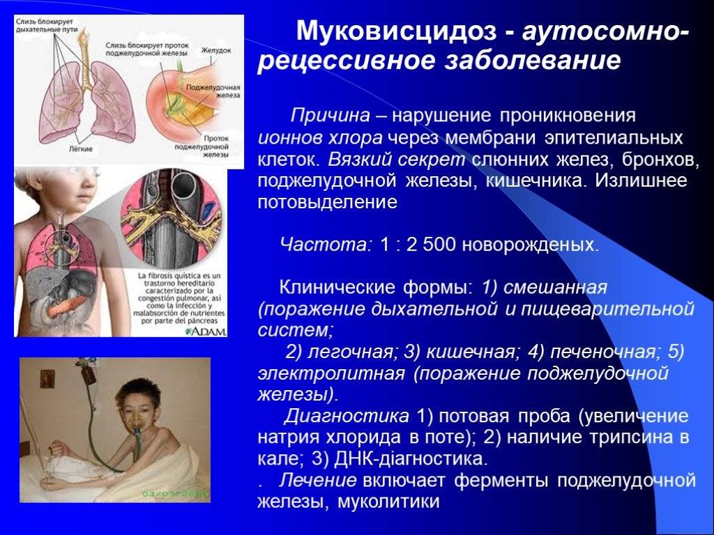 Муковисцидоз у детей - симптомы болезни, профилактика и лечение муковисцидоза у детей, причины заболевания и его диагностика на eurolab