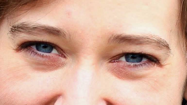 Почему появляются синяки под глазами у грудничка: 10 самых распространённых причин