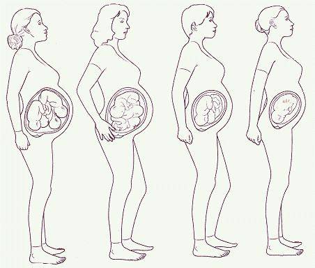 Двойная беременность - симптомы, узи, роды | аборт в спб