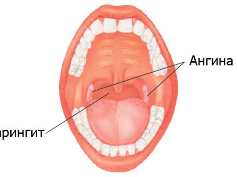 Заболевания полости рта у взрослого человека - фото, симптомы