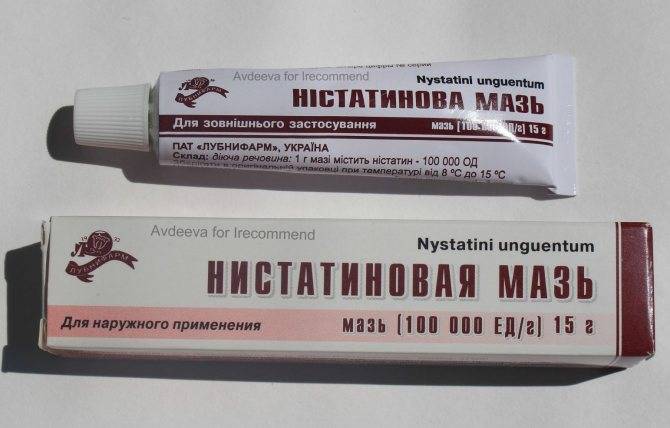 Себорейный дерматит: от диагностики к лечению