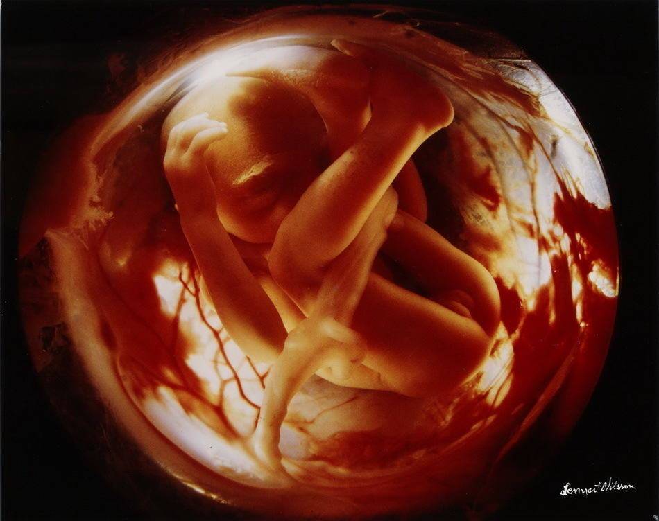 Развитие эмбриона человека