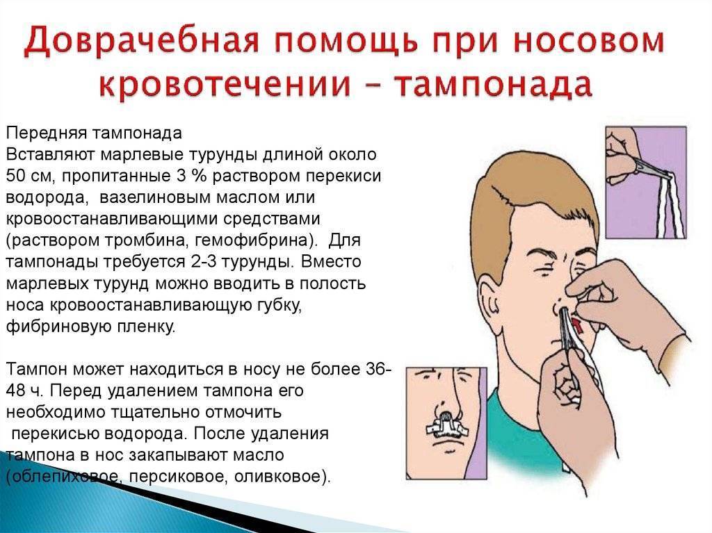 Перелом носа у ребёнка: как определить повреждение или ушиб костей, первые признаки травмы и что делать при ней