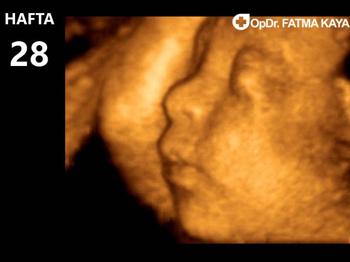 28 неделя беременности: признаки и ощущения женщины, симптомы, развитие плода