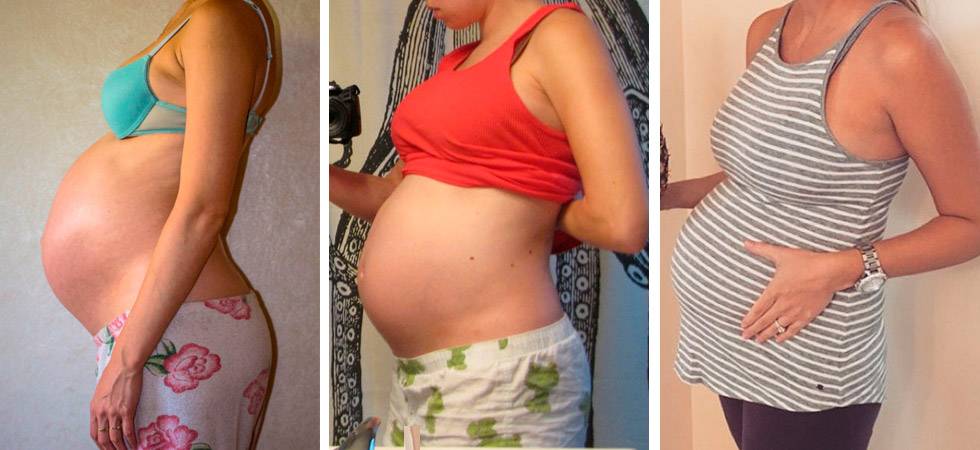 ➤ 31 неделя беременности всё что нужно знать будущим мамам