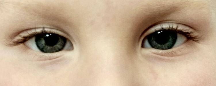 Разные зрачки глаз по размеру у взрослого и ребенка: причины