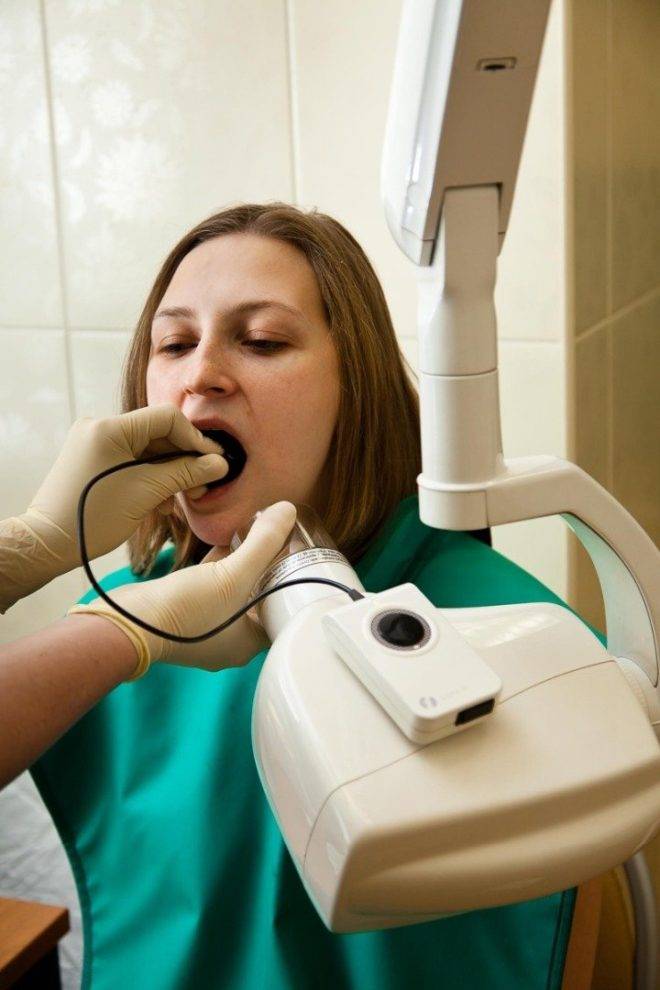 Реминерализация зубной эмали в домашних условиях и в кабинете стоматолога