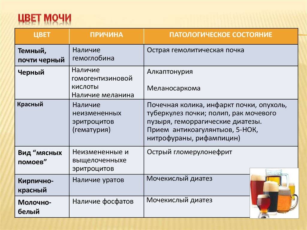 Нормальный цвет мочи у взрослого человека какой фото