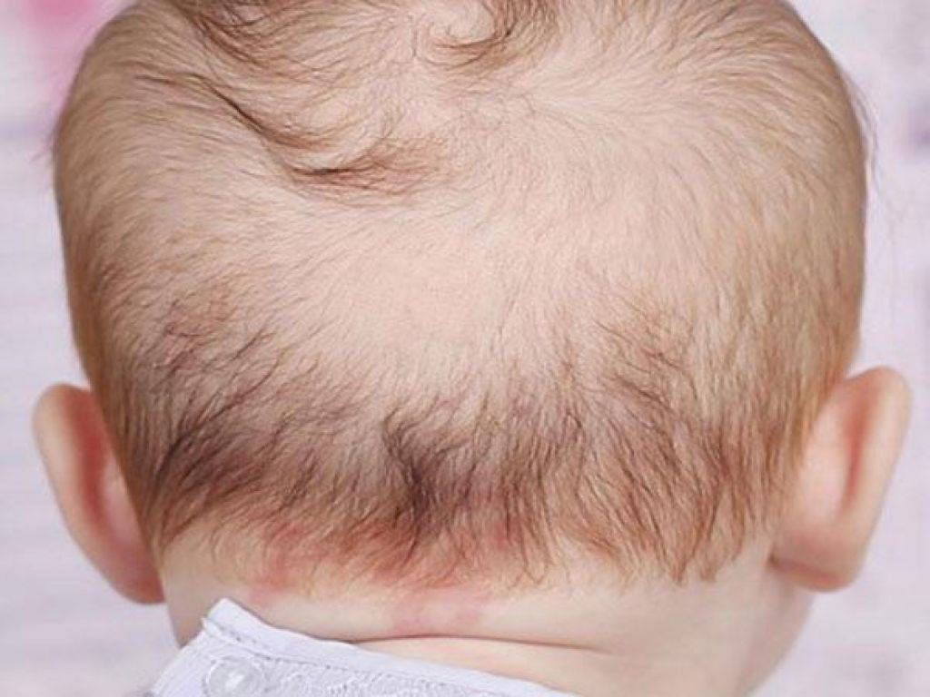 Почему волосы у ребенка растут плохо — возможные причины