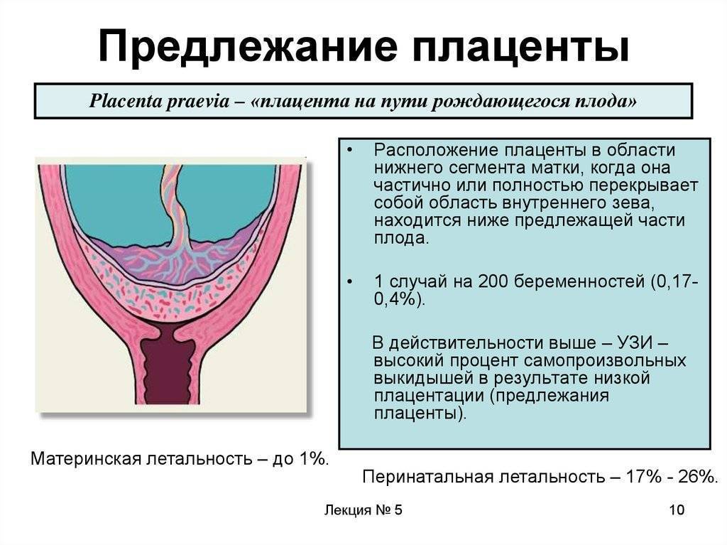 Что такое низкая плацентация при беременности? чем опасна низкая плацентация при беременности?