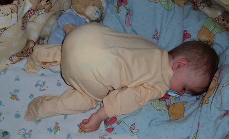 Потеет голова во сне у ребенка