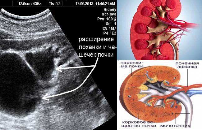 Патологии почек у плода: что и когда показывает экспертное узи при беременности * клиника диана в санкт-петербурге