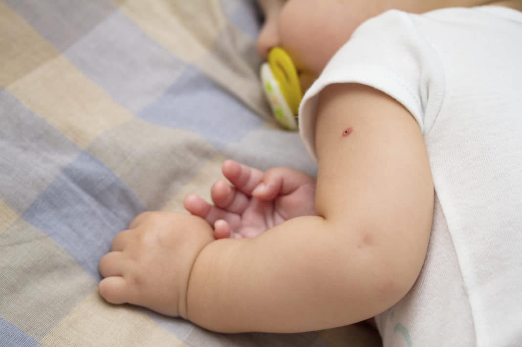 Реакция на прививку бцж у новорожденных и детей в 6-7 лет: норма и отклонения