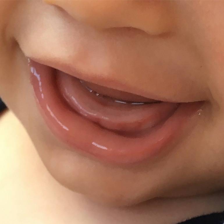 Мифы о детской стоматологии