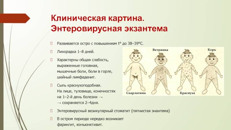 Экзантема | симптомы | диагностика | лечение - docdoc.ru