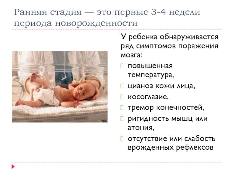 Дцп у новорожденных: симптомы и признаки, как проявляется и распознается