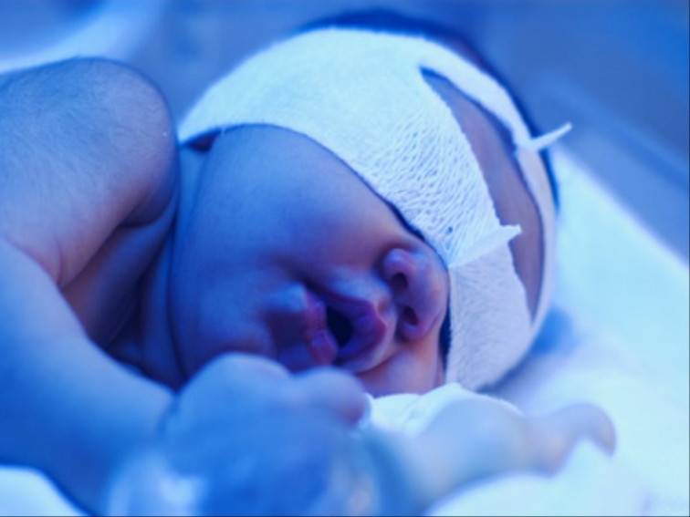 Желтуха новорожденных: виды, причины, особенности развития