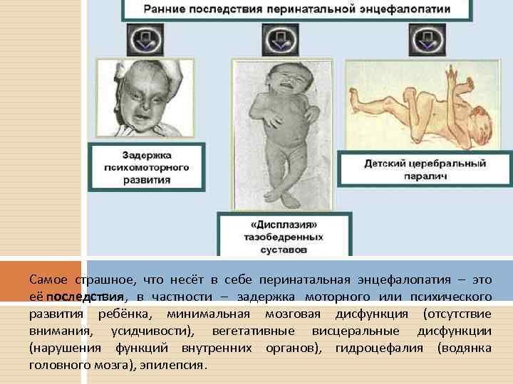Резидуальная энцефалопатия у ребенка с гипертензионным синдромом: лечение в россии, саратове