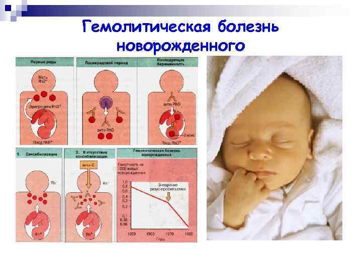 Гемолитическая болезнь новорожденного: признаки, лечение — онлайн-диагностика