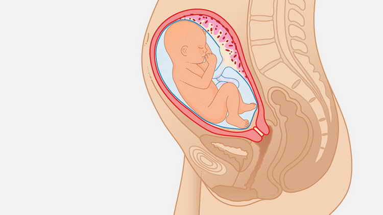 26 неделя беременности: что происходит с малышом и мамой, развитие плода, вес и рост — медицинский женский центр в москве