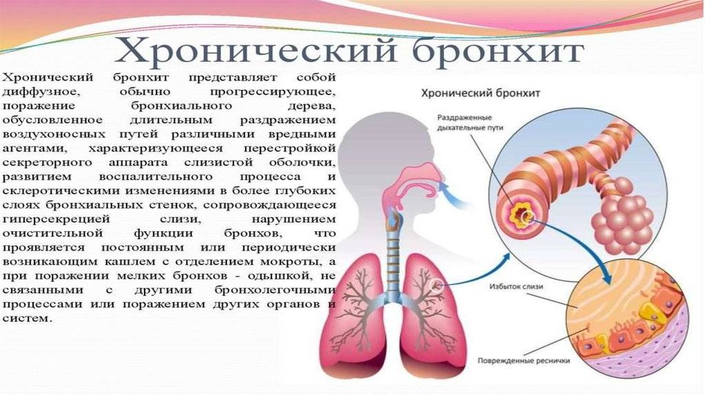 Острый бронхит у детей презентация