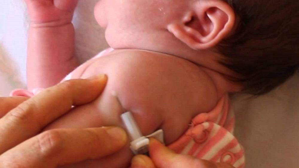 Прививка бцж у новорожденных: от чего, как протекает реакция - поликлиника №8