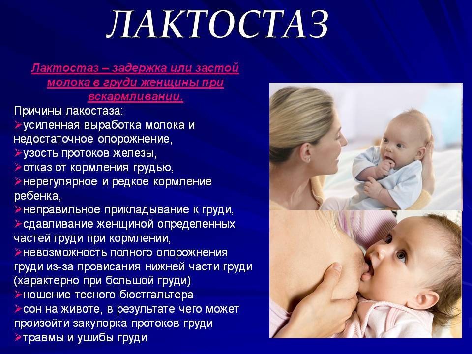 Мастит: симптомы, лечение и профилактика | pampers ru