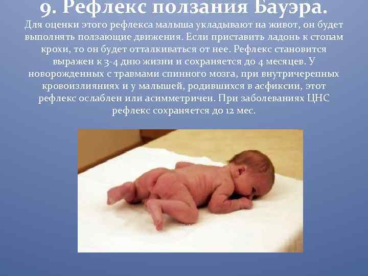 Эффект моро у младенцев до какого возраста ~ детская городская поликлиника №1 г. магнитогорска
