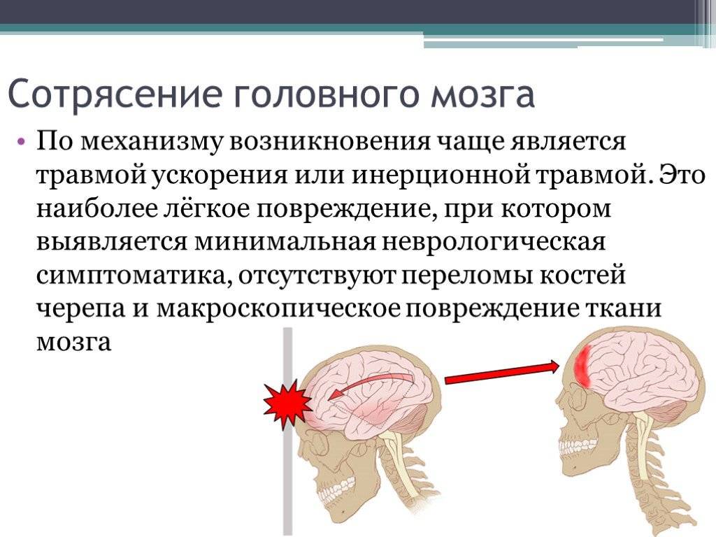 Сотрясение головного мозга - симптомы болезни, профилактика и лечение сотрясения головного мозга, причины заболевания и его диагностика на eurolab