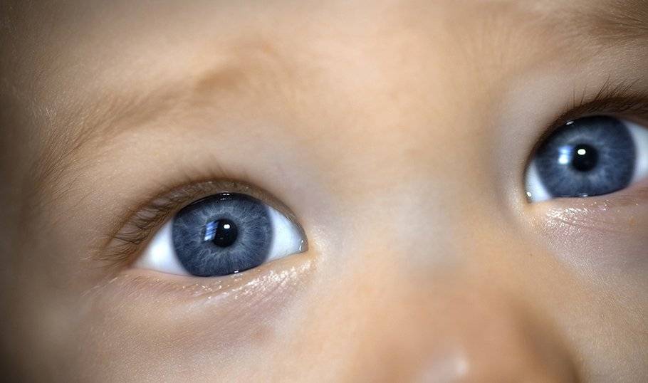Синяки и темные круги под глазами у ребенка