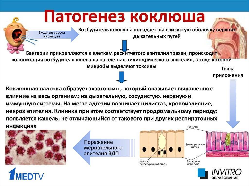 Коклюш. заболевания.