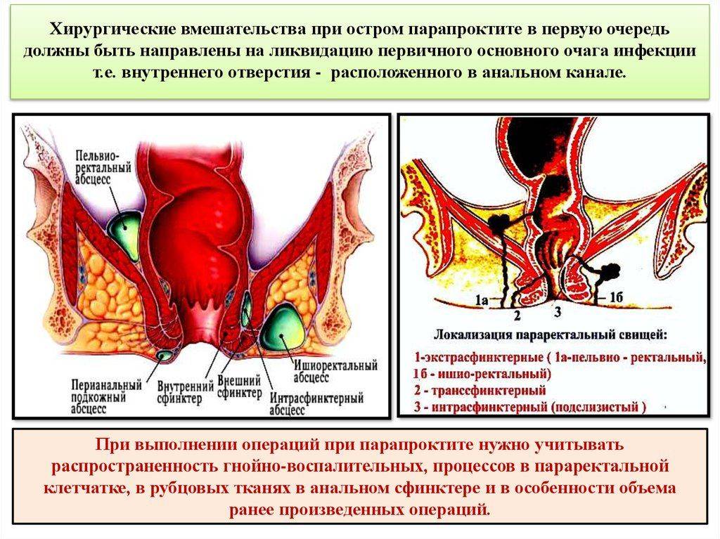 Гипертонус мышц у грудничка