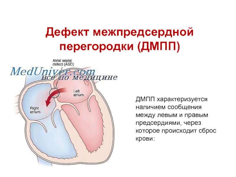 Открытое овальное окно у новорожденных