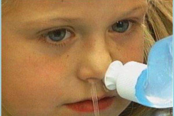 Синусит у детей: лечение и симптомы