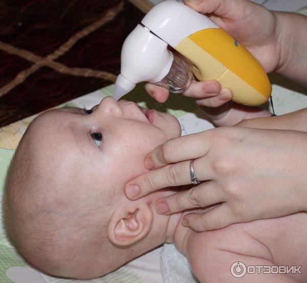 Как правильно пользоваться назальным аспиратором для новорожденных