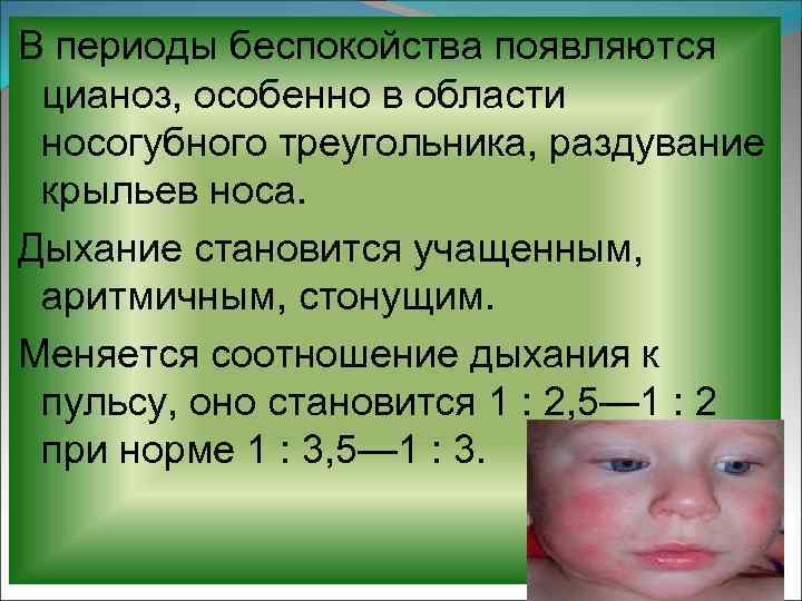 Цианоз кожи у детей