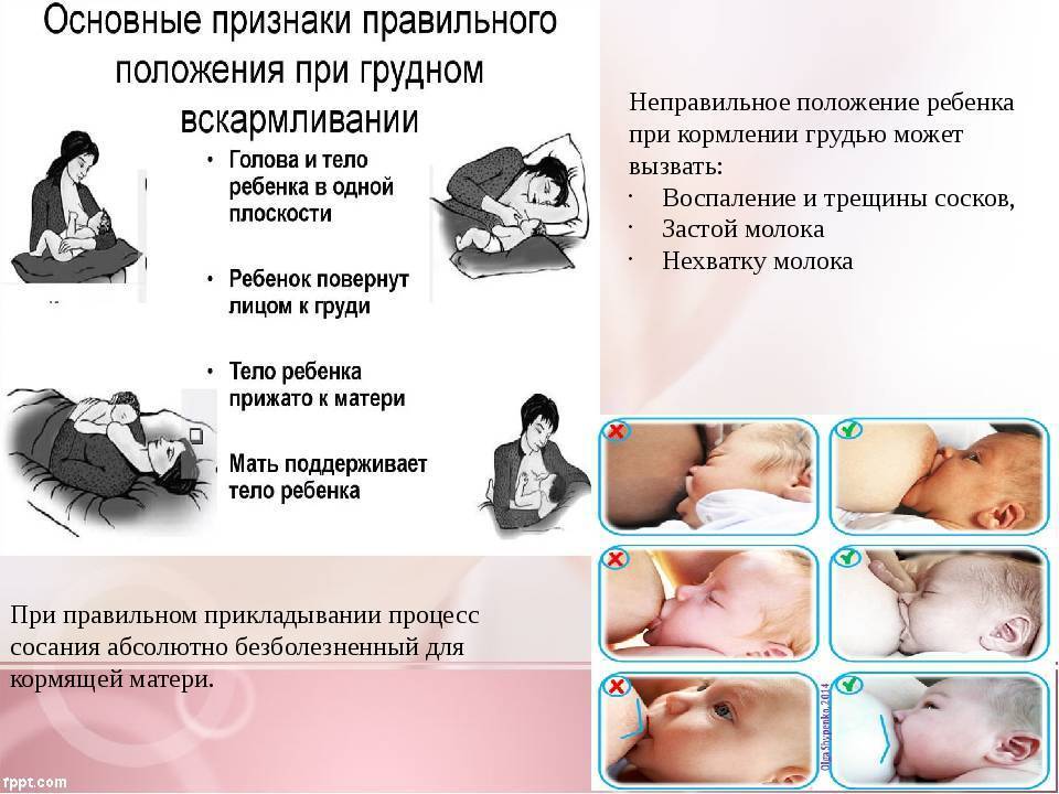 Изменения груди во время беременности