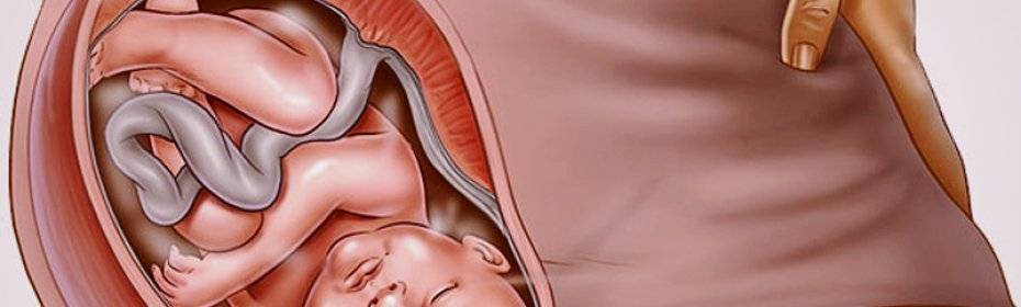 Тонус матки при беременности в 3 семестре : причины, симптоматика, что делать, госпитализация, опасность