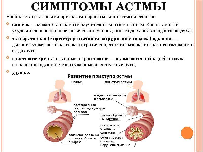 Детский аллерголог в москве - цены, запись на прием | медицинский центр «президент-мед»