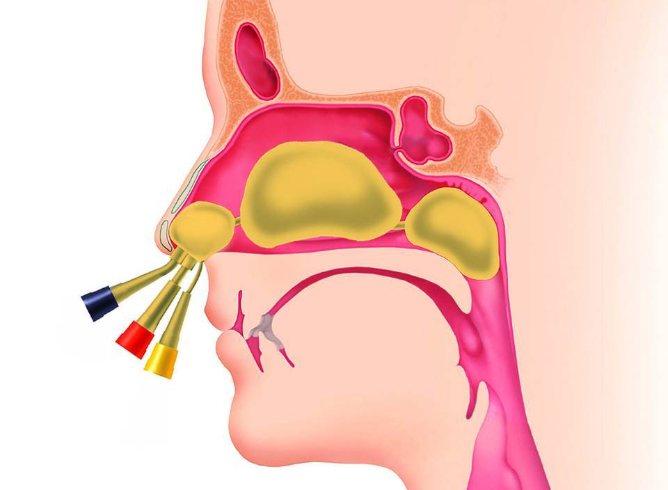 Пазухи носа картинки анатомия гайморит