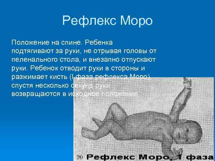 Рефлекс моро - moro reflex - xcv.wiki