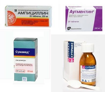 Как выбрать пробиотики для кишечника: список препаратов