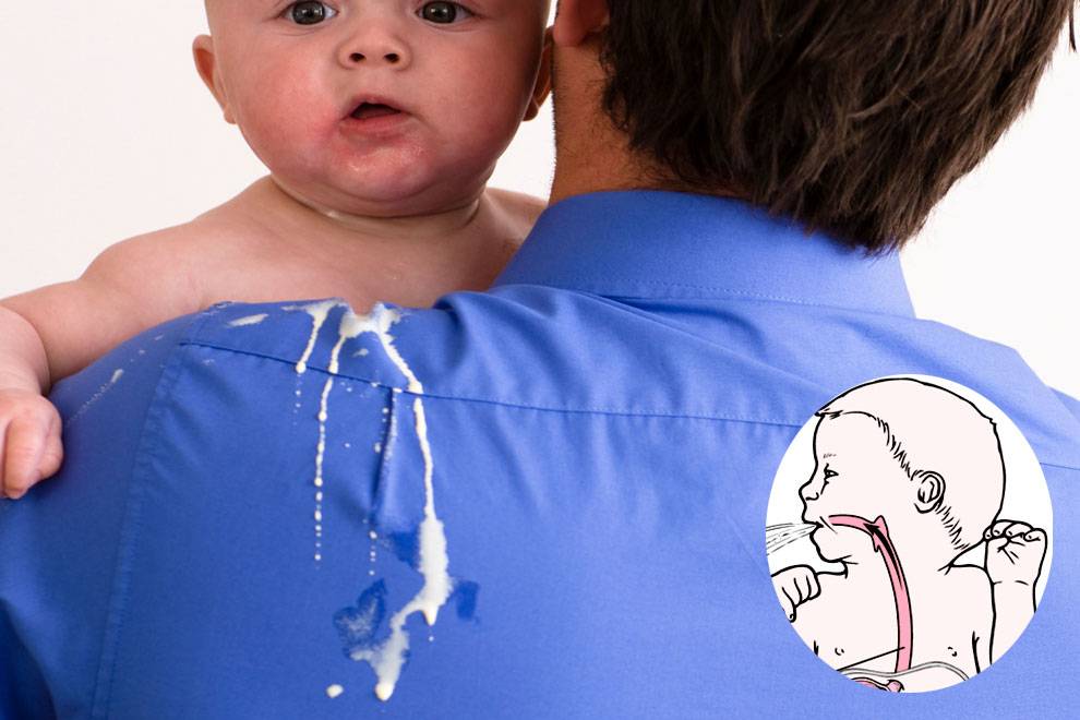 Причины частых срыгиваний малыша после кормления