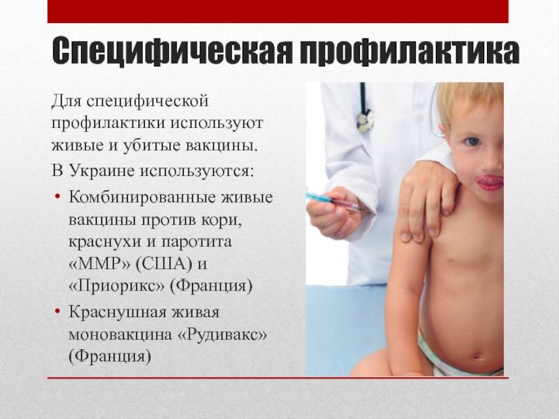 Реакция после прививки корь/краснуха/паротит — 22 ответа врачей на вопрос на сайте спросиврача