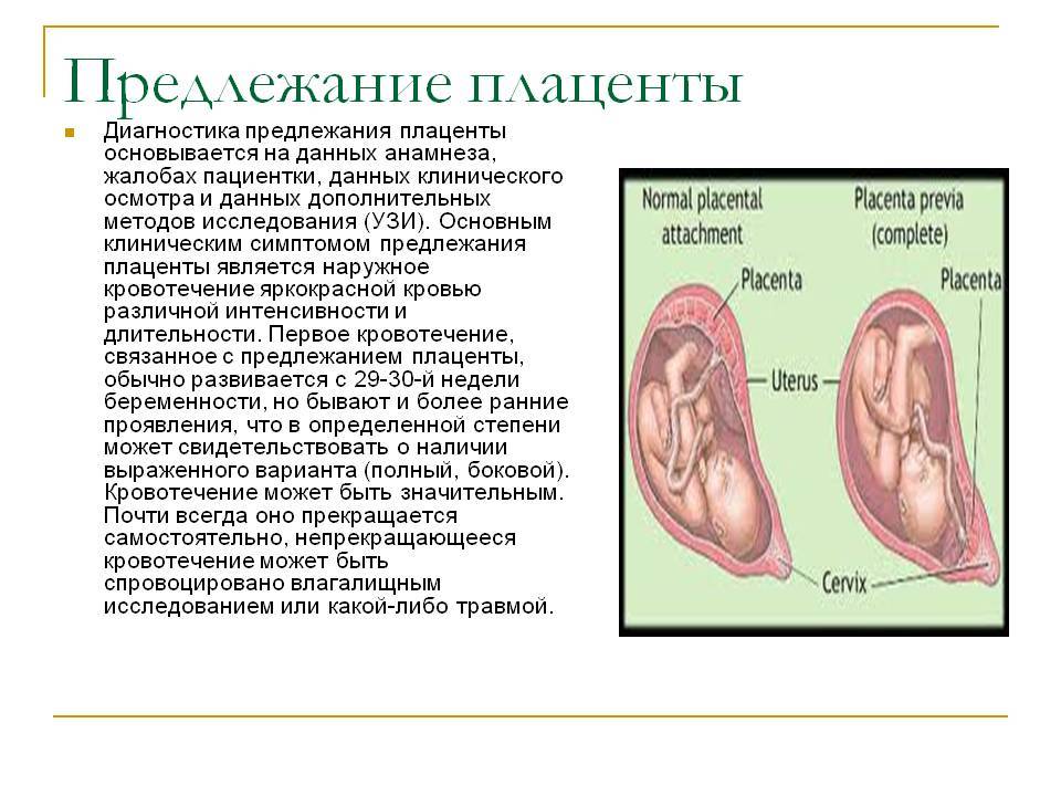 Клиническая картина предлежания плаценты