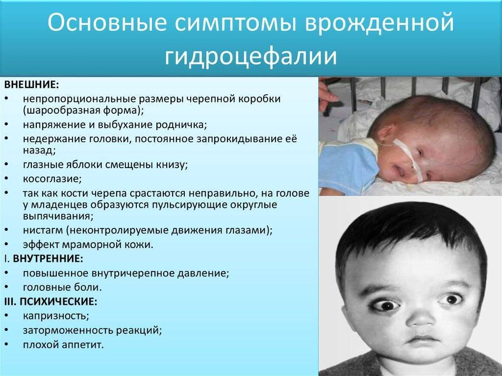 Детские неврологические заболевания: симптомы и причины